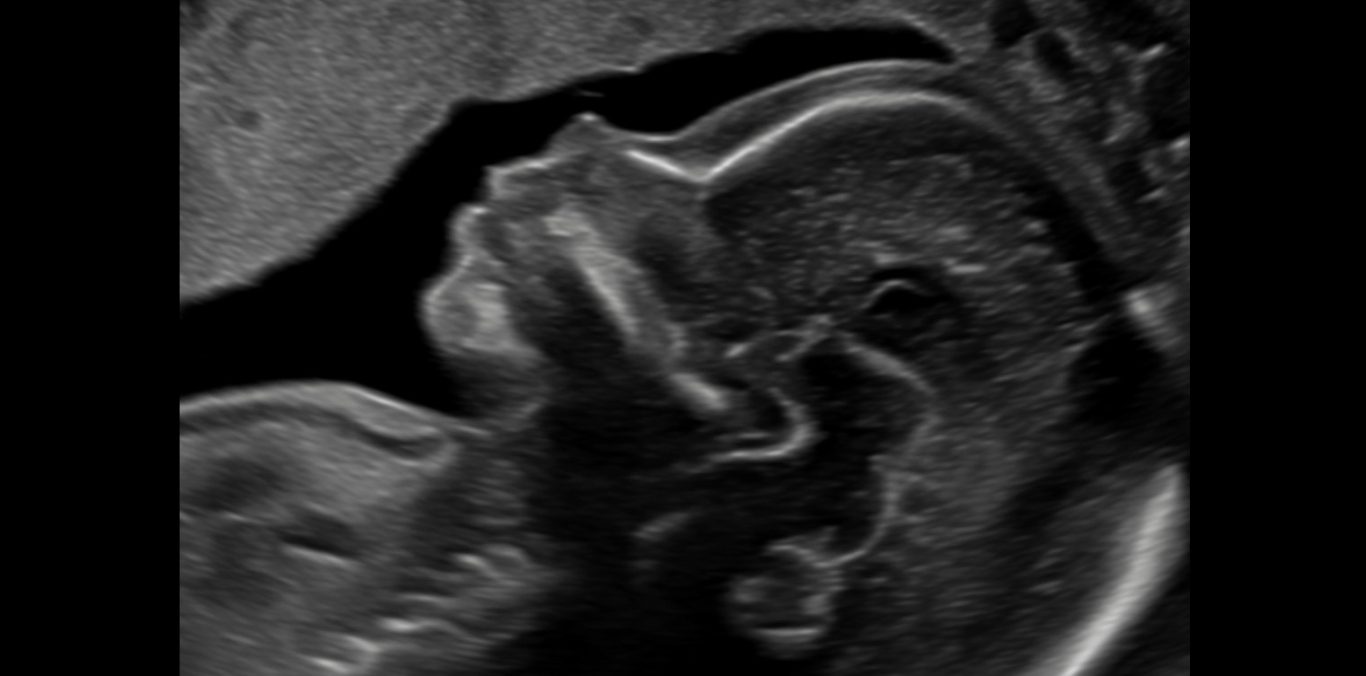 Im Profil sind die Konturen von Stirn, Nase und Lippen gut erkennbar.