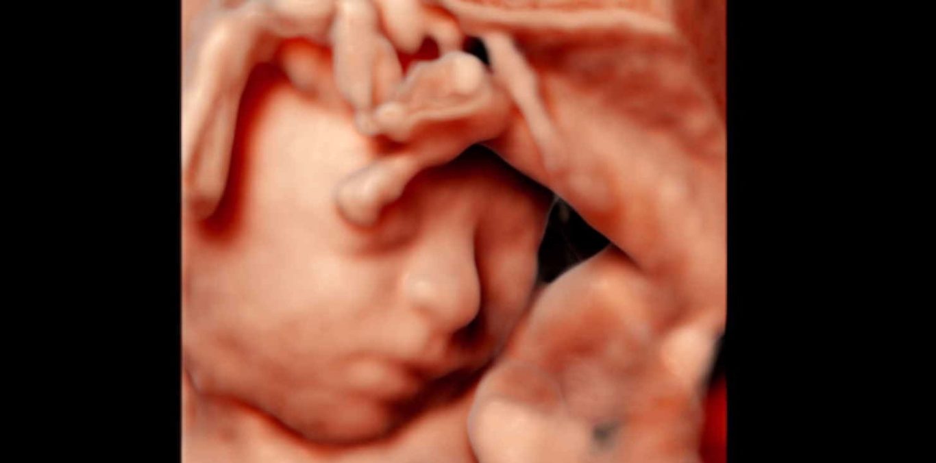 In der 22. SSW bietet der 3D‑Ultraschall erweiterte diagnostische Möglichkeiten.