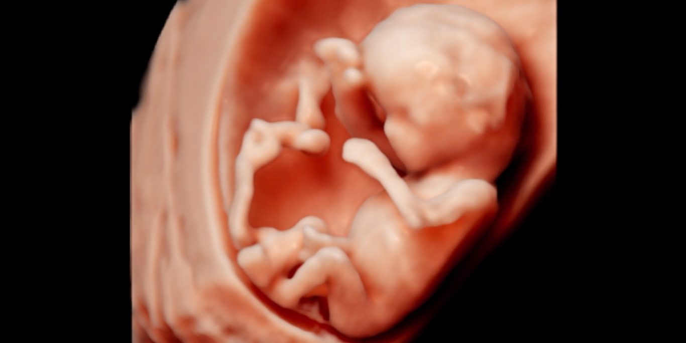 Auch früh kann der 3D-Ultraschall bei der Diagnostik zum Einsatz kommen.