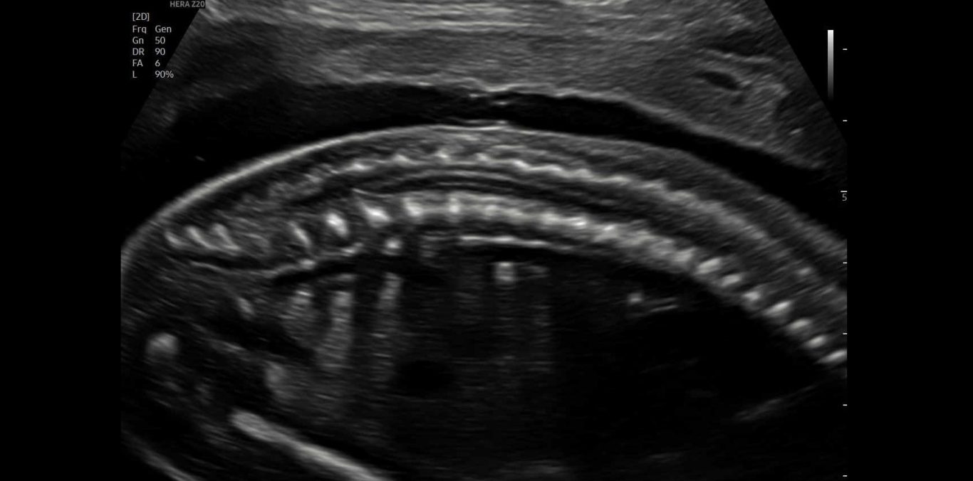 Der Blick auf den geschlossenen Rücken.